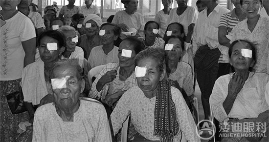 白内障援外组为缅甸196名白内障患者实施复明手术